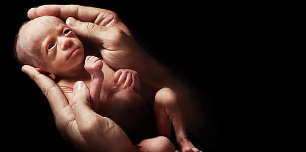 Imagem ilustrando nascimento prematuro, uma das 10 maiores causas de mortes no mundo, especialmente entre recém-nascidos devido à imaturidade dos órgãos.